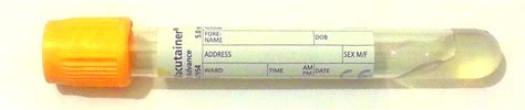 blood bottle toxicology test